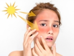 Phải làm gì khi da bị cháy nắng